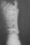 Spine